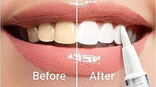 WHITELY Premium Teeth Whitening Pen - 0.067Oz