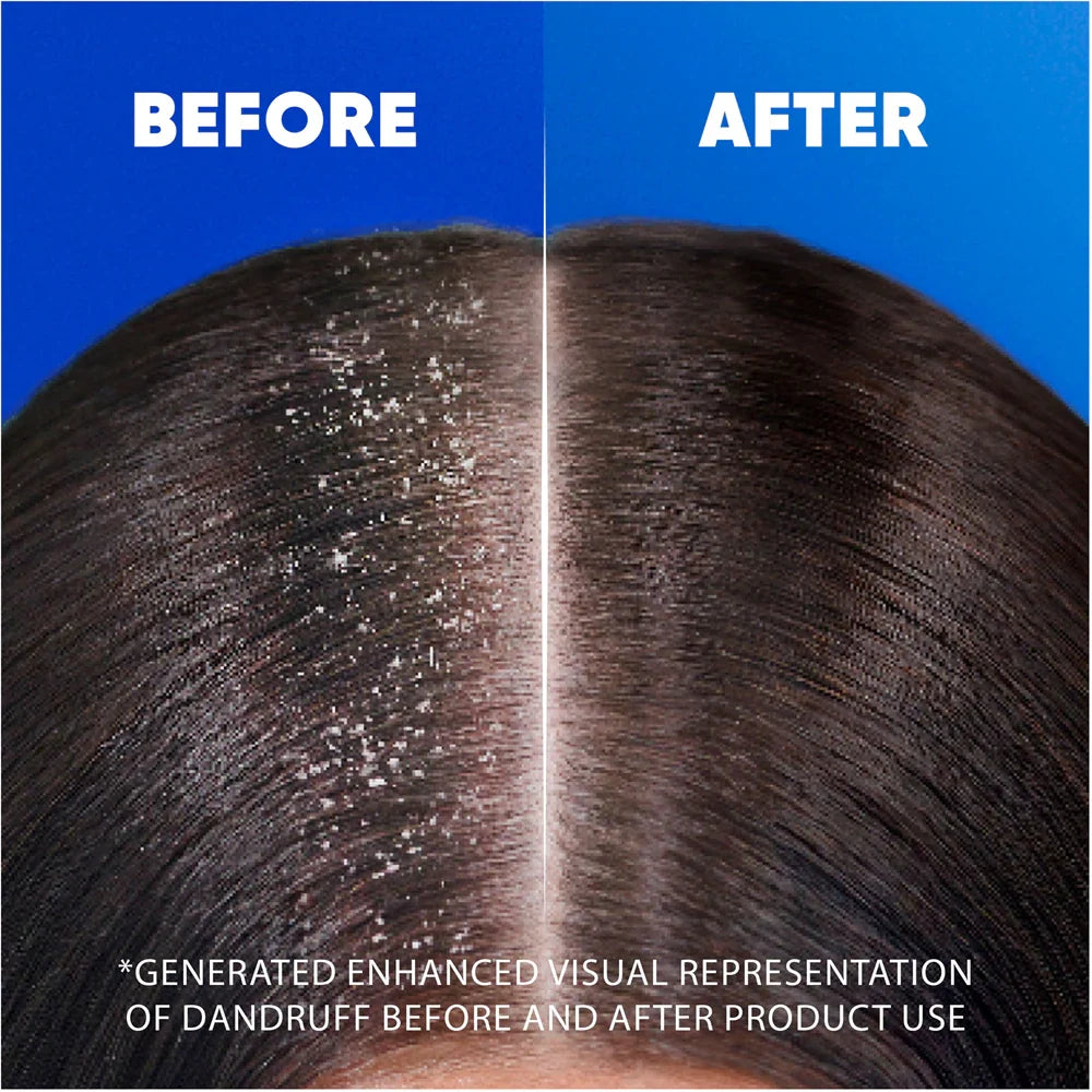 Head & Shoulders Shampoo & Conditioner 2-in-1 Classic Clean 250ml - view 5