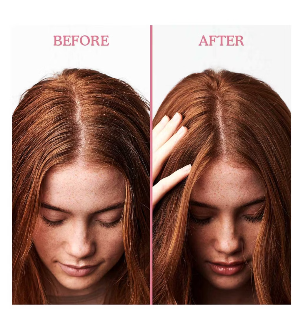 Umberto Giannini Scalp Restore Scalp Reviving Anti-Dandruff Conditioner 250ml - available online | CC Hair & Beauty UK