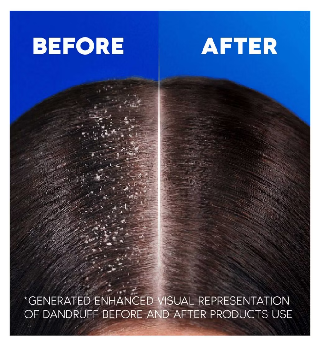 Head & Shoulders 2 in 1 Fresh anti Dandruff Shampoo & Conditioner 330ml | CC Hair & Beauty UK